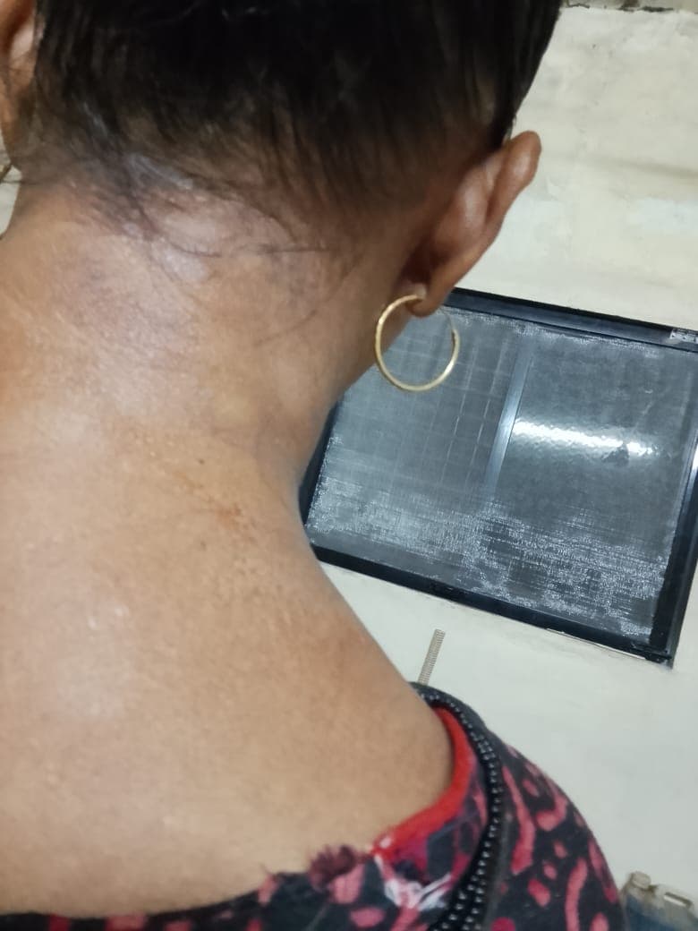 Case 1, after treatment, view 1