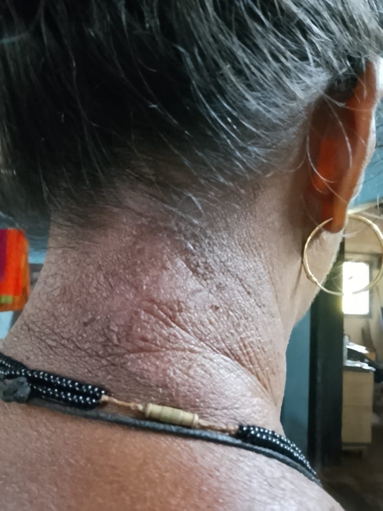 Case 1, before treatment, view 1