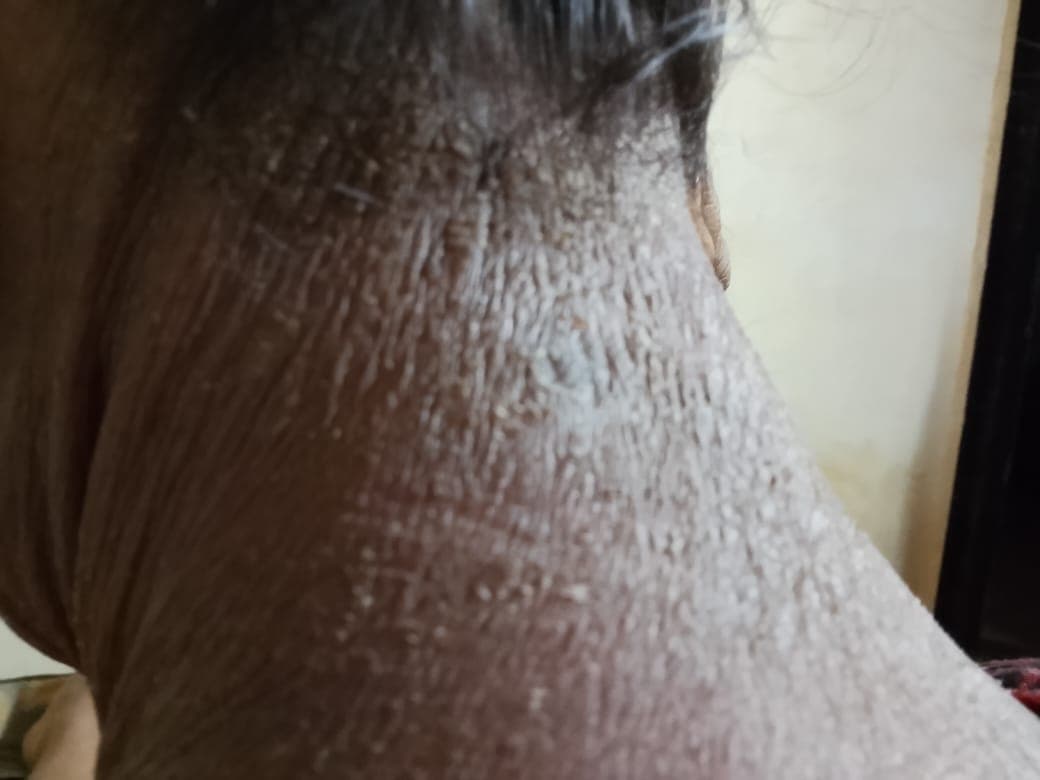 Case 1, before treatment, view 2
