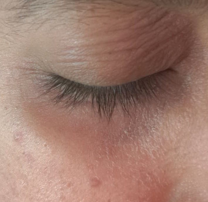Case 2, after treatment, view 1