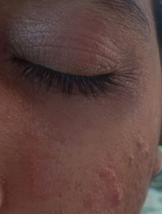 Case 2, after treatment, view 2