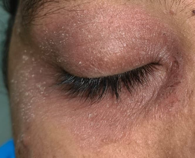 Case 2, before treatment, view 1