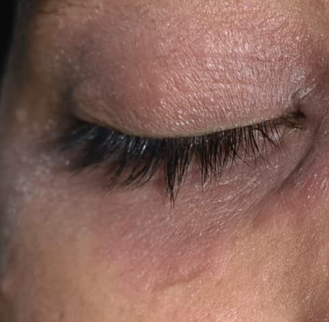 Case 2, before treatment, view 2