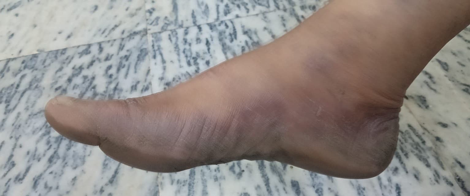 Case 3, after treatment, view 1