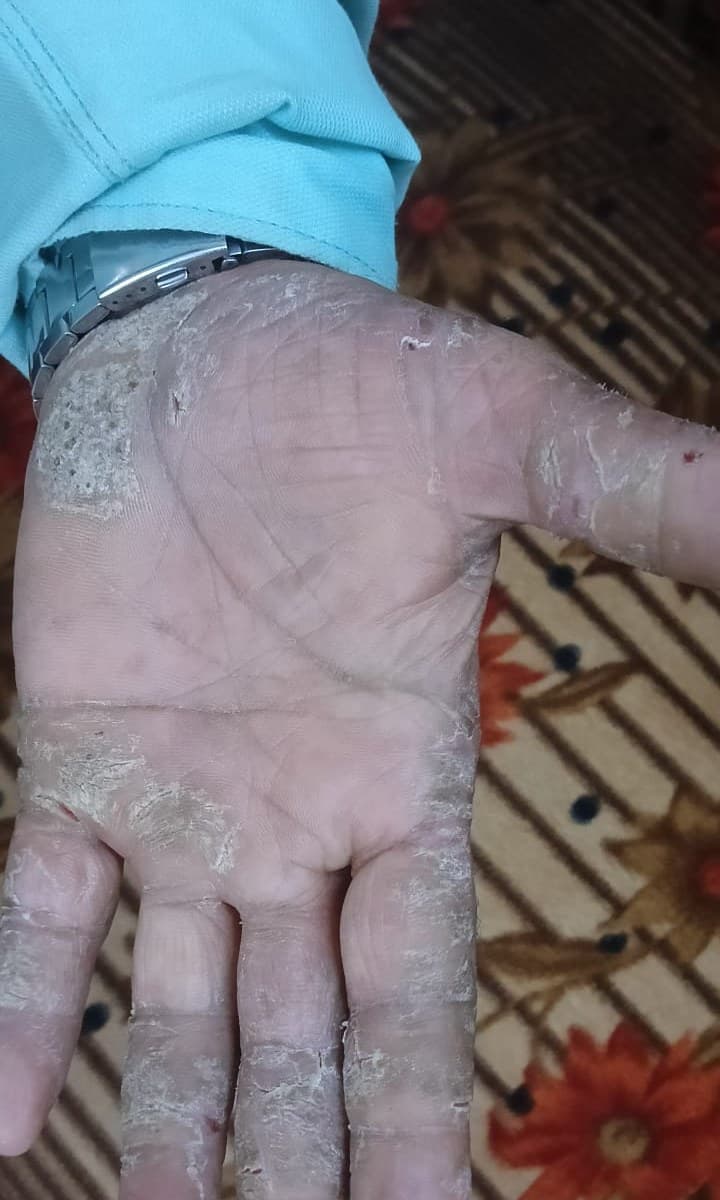 Case 3, before treatment, view 1