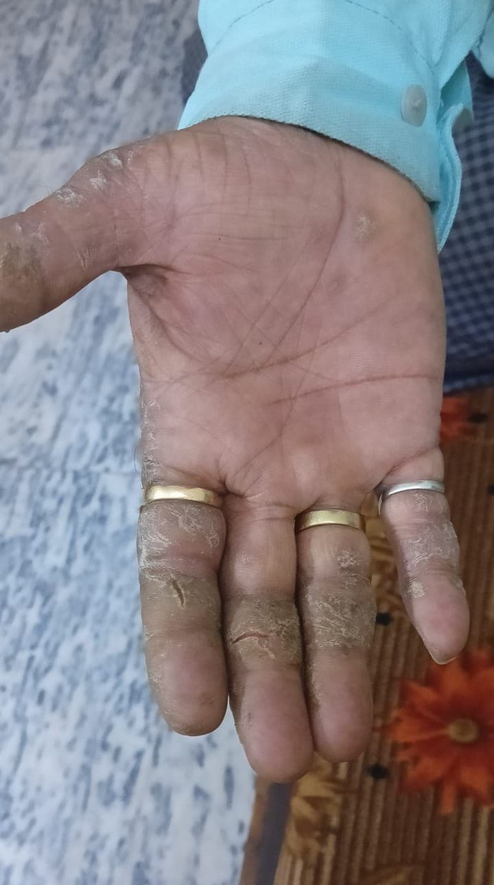 Case 3, before treatment, view 2