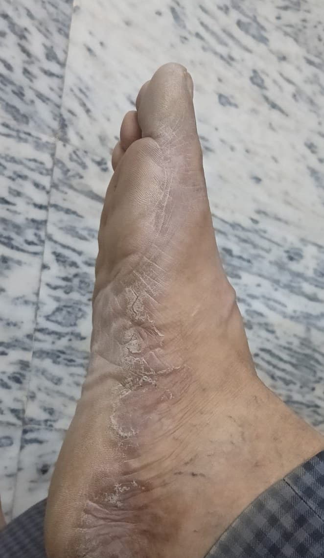 Case 3, before treatment, view 4
