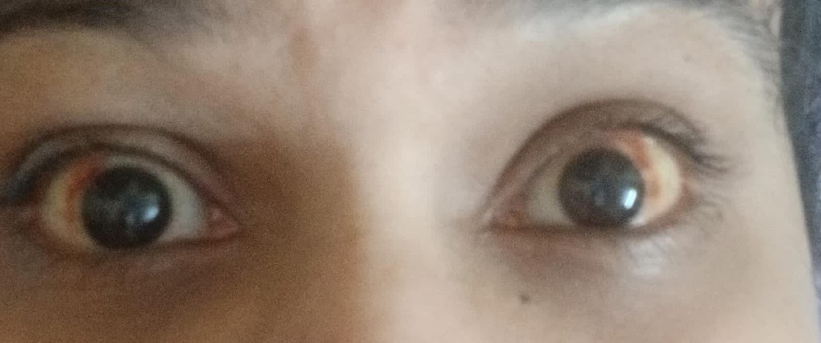 Case 4, after treatment, view 1