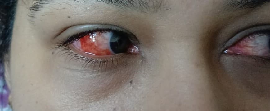 Case 4, before treatment, view 1