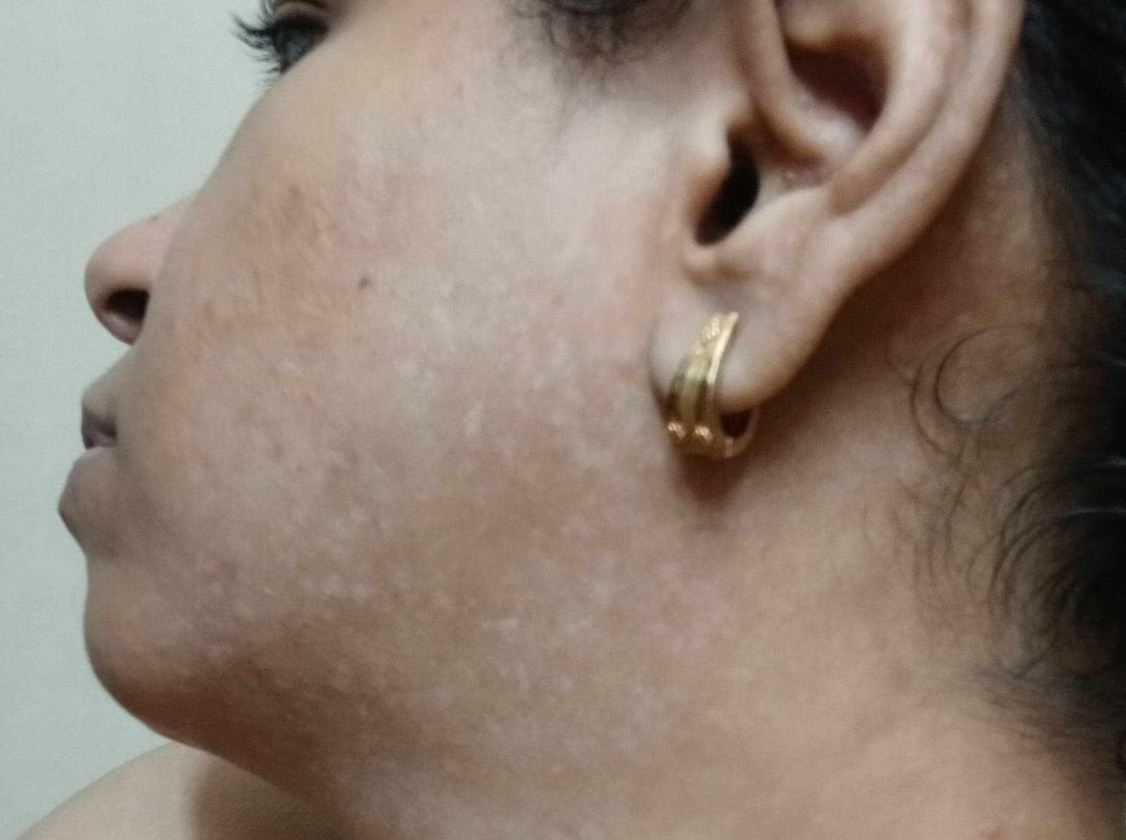 Case 5, after treatment, view 1