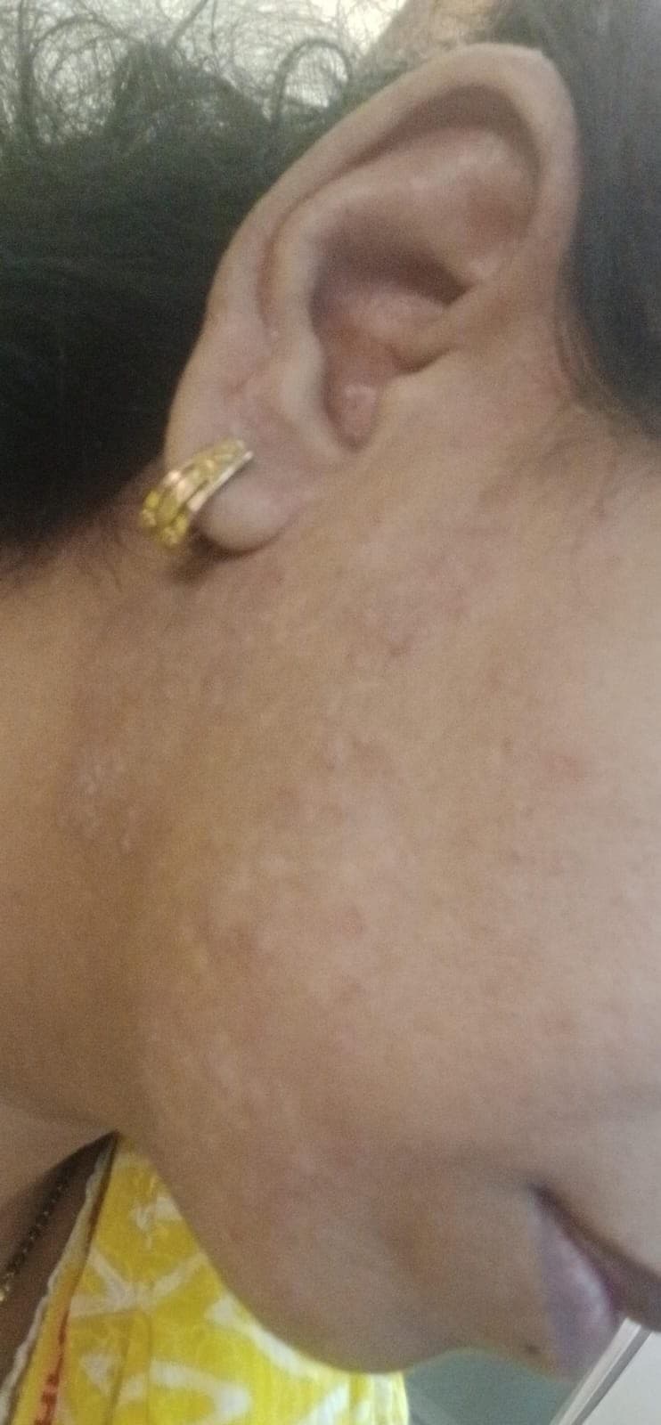 Case 5, after treatment, view 2