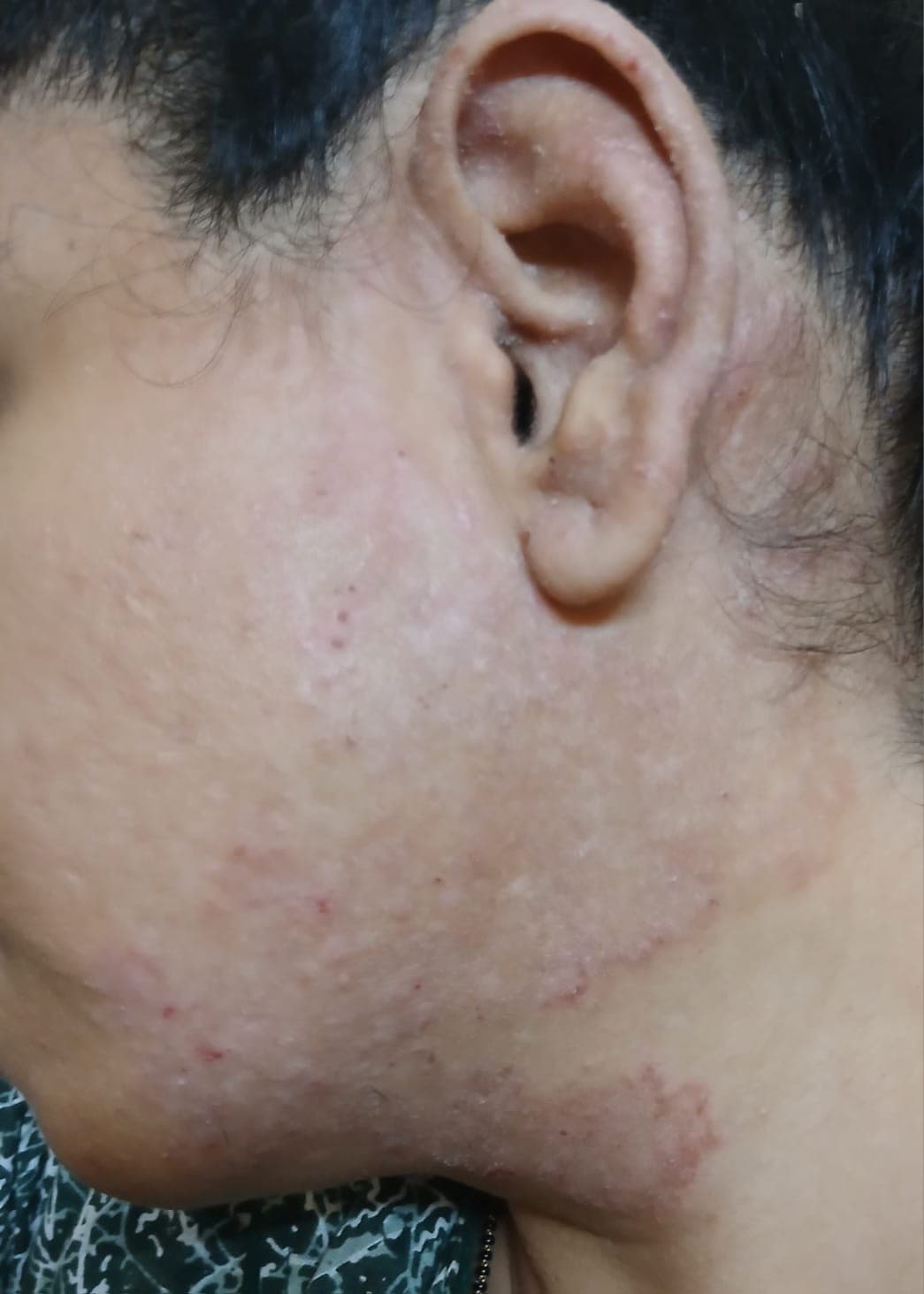 Case 5, before treatment, view 1