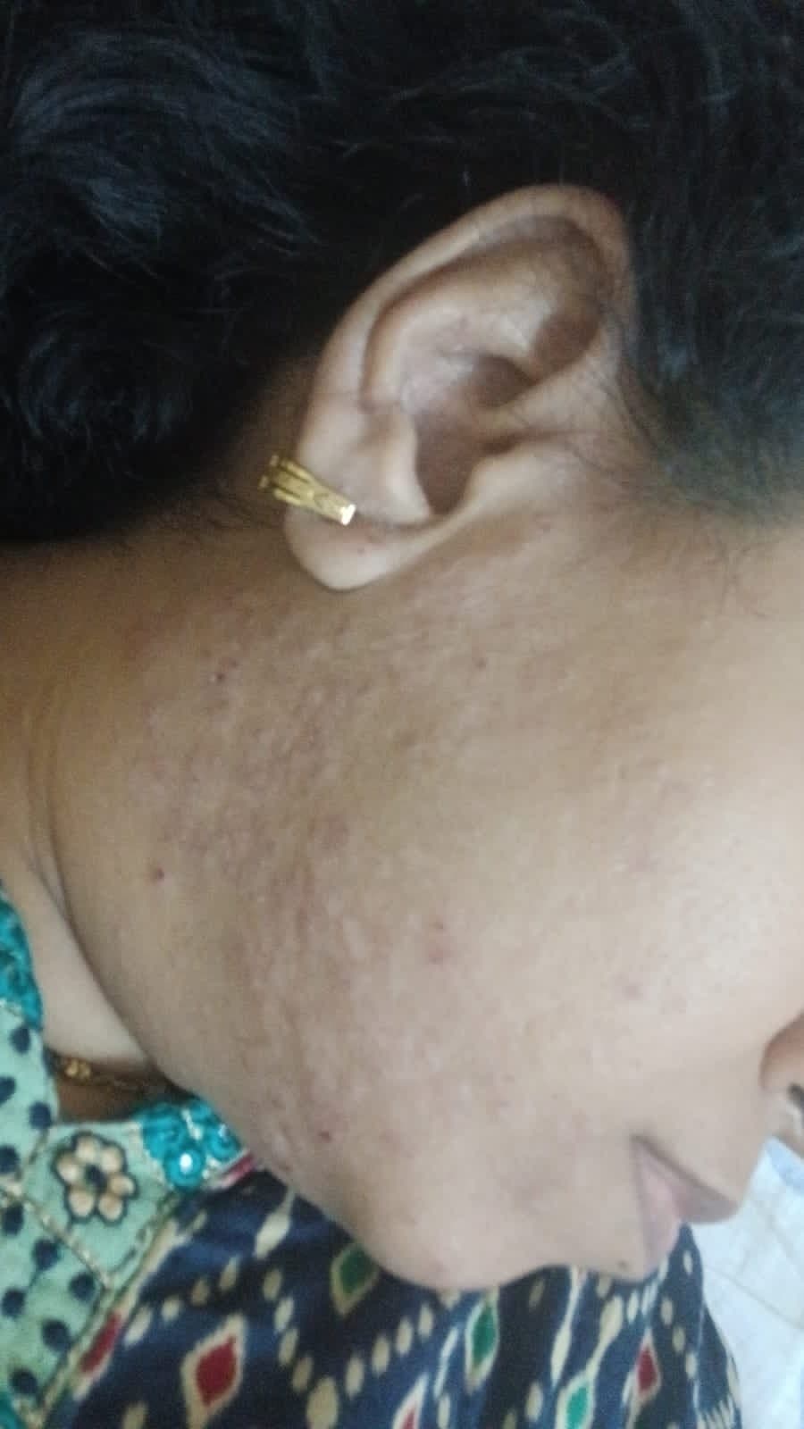 Case 5, before treatment, view 2